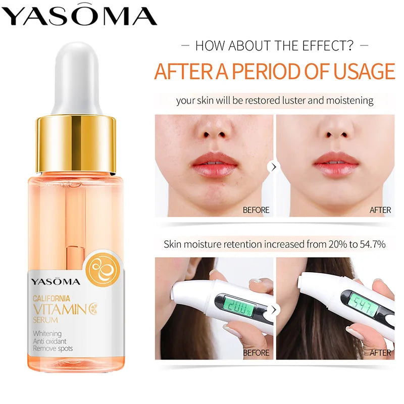 YASOMA Vitamin C Face Serum