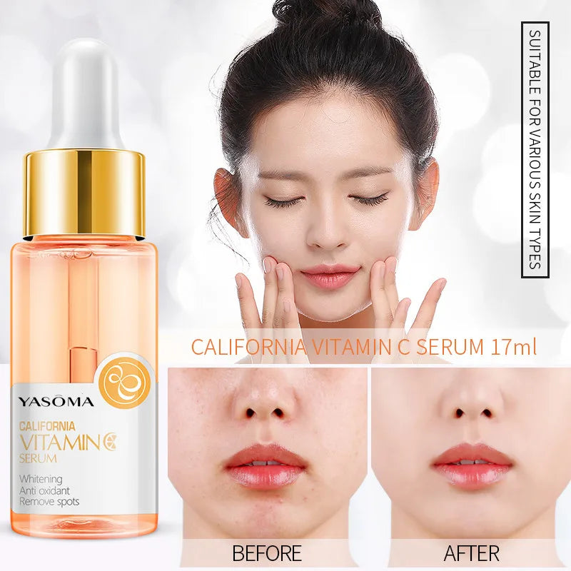 YASOMA Vitamin C Face Serum